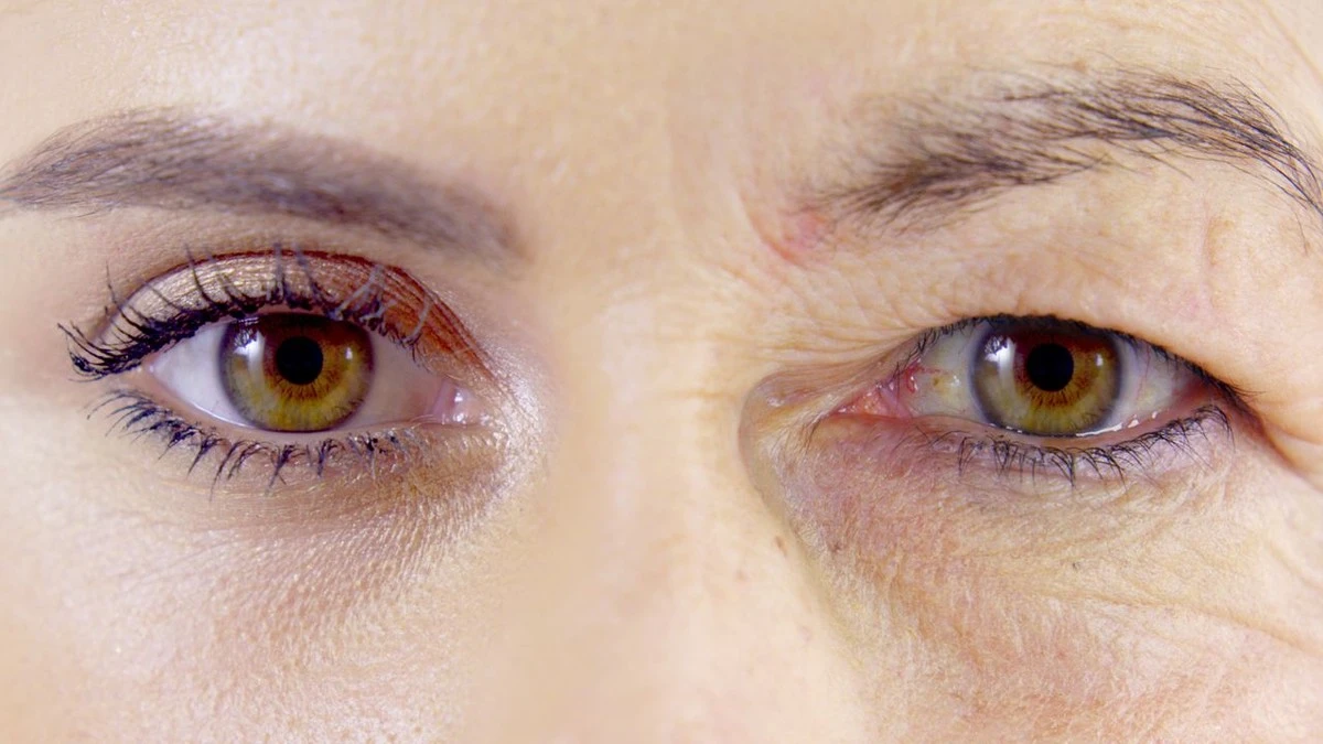 Despídete de los párpados caídos: métodos caseros y trucos de belleza que sí funcionan - image 1