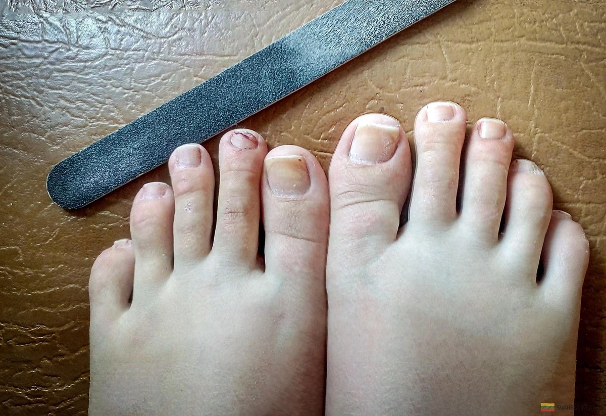 El secreto del baño de pies que revitaliza tus uñas: adiós amarilleo y debilidad