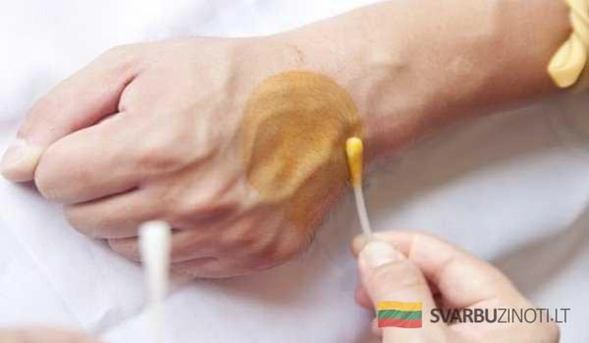 ¿Tu piel luce apagada o te sientes sin energía? La sencilla prueba de yodo que revela tus carencias ocultas