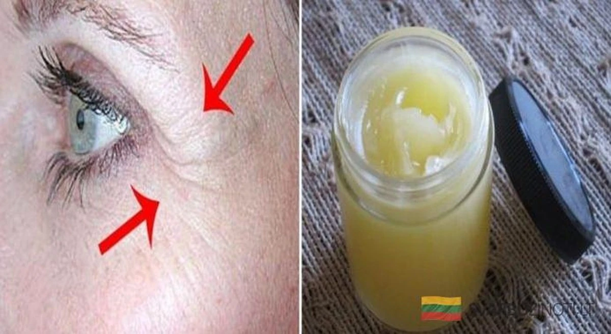 Elimina las arrugas en 7 días con esta crema casera