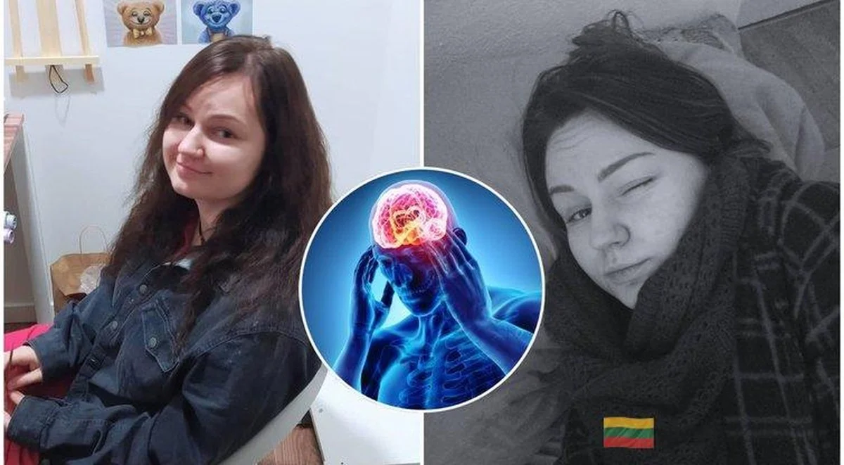 La migraña con aura: cómo un dolor de cabeza persistente le advirtió a una mujer sobre una enfermedad grave