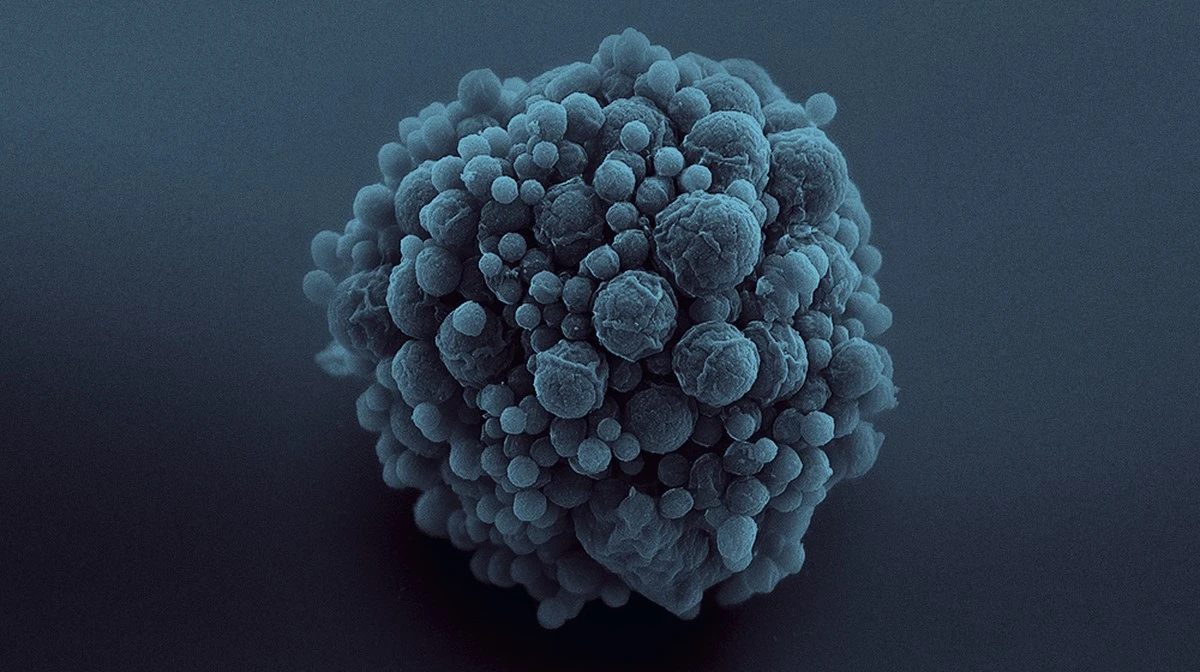 ¿Qué es eso que vive en el agua y no es ni virus ni bacteria? - image 1